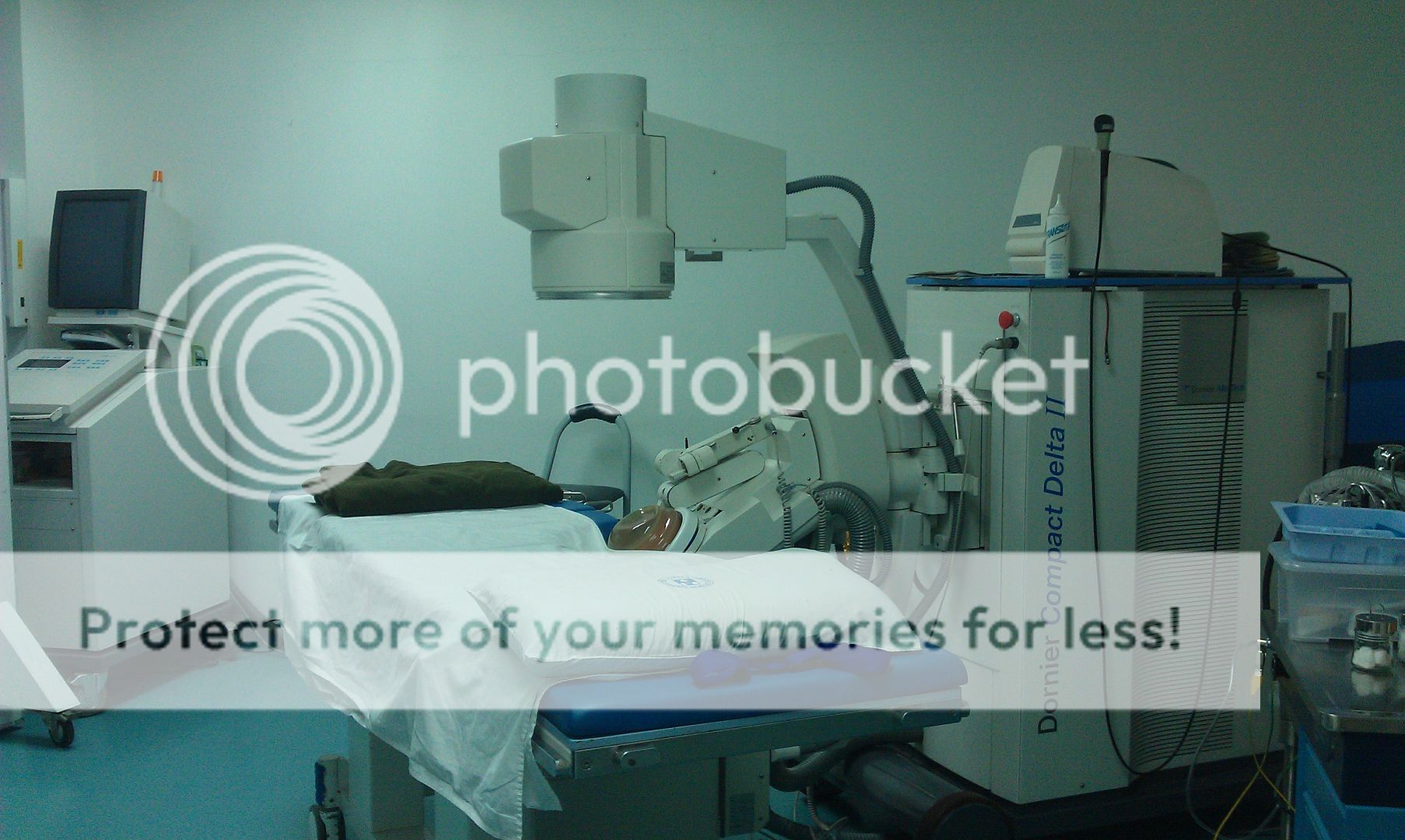 shockwave for kidney stone cost (cost ESWL in the Philippines)